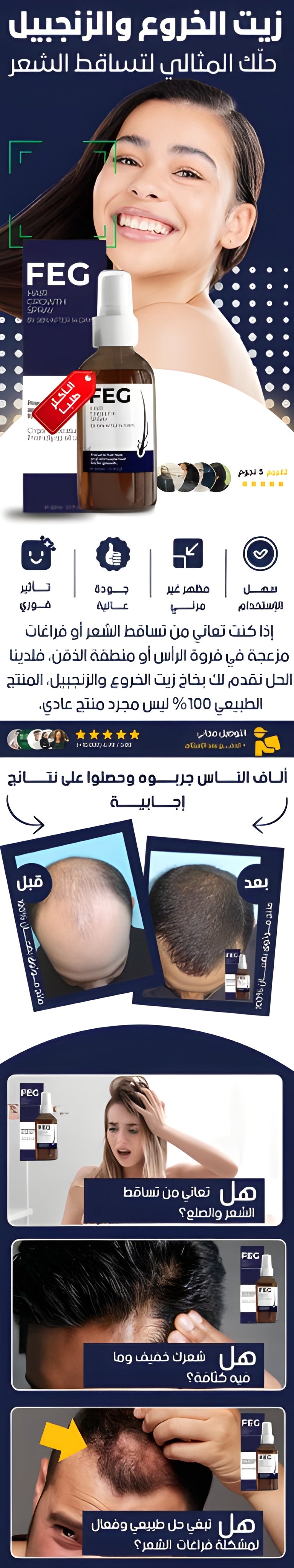 FEG Hair Growth Spray