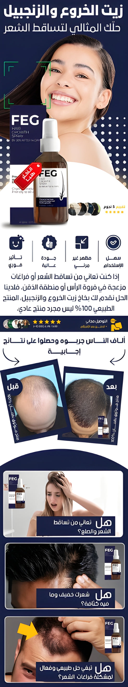 FEG Hair Growth Spray